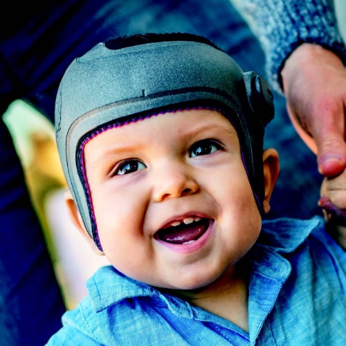 Toddler wearing cranial helmet