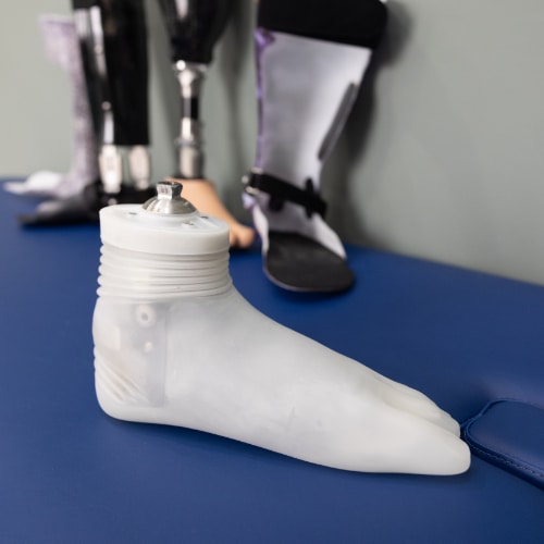 Prosthetic foot