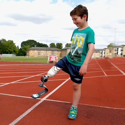 Boy with prosthetic leg